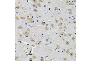 Immunohistochemistry of paraffin-embedded rat brain using RRAGC Antibody (ABIN5975563) at dilution of 1/100 (40x lens). (GTR2 Antikörper)