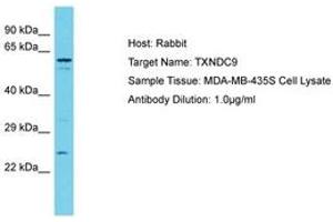 Image no. 1 for anti-Thioredoxin Domain Containing 9 (TXNDC9) (N-Term) antibody (ABIN6750580) (TXNDC9 Antikörper  (N-Term))