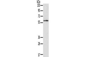 Gel: 8 % SDS-PAGE, Lysate: 40 μg, Lane: Human placenta tissue, Primary antibody: ABIN7191225(KLHL8 Antibody) at dilution 1/200, Secondary antibody: Goat anti rabbit IgG at 1/8000 dilution, Exposure time: 10 seconds (KLHL8 Antikörper)