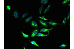 Immunofluorescent analysis of Hela cells using ABIN7160433 at dilution of 1:100 and Alexa Fluor 488-congugated AffiniPure Goat Anti-Rabbit IgG(H+L) (PLP1 Antikörper  (AA 143-197))