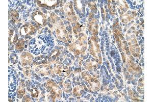 CDH3 antibody was used for immunohistochemistry at a concentration of 4-8 ug/ml to stain Epithelial cells of renal tubule (arrows) in Human Kidney. (P-Cadherin Antikörper)