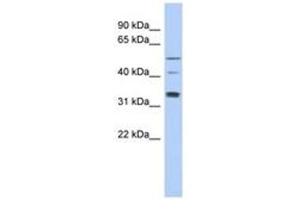 TCP11 Antikörper  (AA 143-192)
