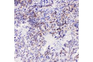 IHC analysis of Integrin alpha 3 using anti-Integrin alpha 3 antibody (ABIN6719410). (ITGA3 Antikörper)