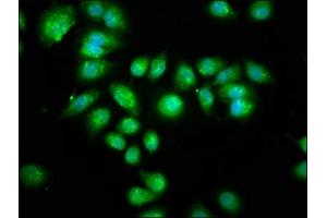 Immunofluorescence staining of A549 cells with ABIN7169324 at 1:133, counter-stained with DAPI. (AANAT Antikörper  (AA 1-207))
