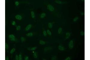 Anti-ALDH1L1 mouse monoclonal antibody (ABIN2452748) immunofluorescent staining of COS7 cells transiently transfected by pCMV6-ENTRY ALDH1L1 (RC213720). (ALDH1L1 Antikörper)