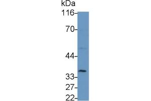 Detection of IL2Ra in Porcine Lymph node lysate using Polyclonal Antibody to Interleukin 2 Receptor Alpha (IL2Ra) (CD25 Antikörper  (AA 22-236))