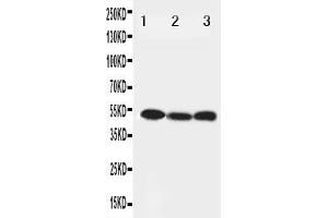 Anti-Beclin 1 antibody, Western blotting Lane 1: HELA Cell Lysate Lane 2: SW620 Cell Lysate Lane 3: PANC Cell Lysate (Beclin 1 Antikörper  (Middle Region))
