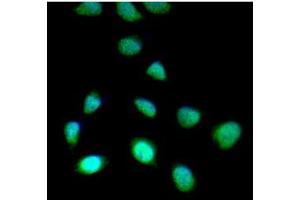 ICC/IF analysis of SET7/9 in HeLa cells line, stained with DAPI (Blue) for nucleus staining and monoclonal anti-human SET7/9 antibody (1:100) with goat anti-mouse IgG-Alexa fluor 488 conjugate (Green). (SET7/9 Antikörper)