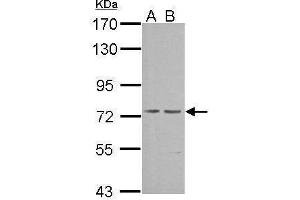 WB Image Sample (30 ug of whole cell lysate) A: NIH-3T3 B: JC 7. (PRKG1 Antikörper  (Center))