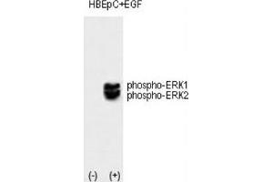 Western Blotting (WB) image for anti-Mitogen-Activated Protein Kinase 1/3 (MAPK1/3) (pThr202), (pTyr204) antibody (ABIN3001885) (ERK1/2 Antikörper  (pThr202, pTyr204))