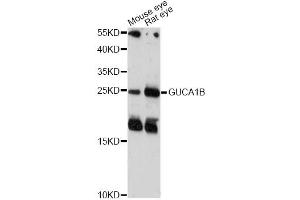 Western blot analysis of extracts of various cell lines, using GUCA1B antibody (ABIN6290449) at 1:1000 dilution.