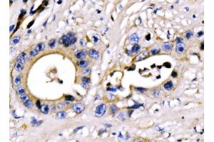 IHC analysis of PAR-3/PARD3 using anti-PAR-3/PARD3 antibody (ABIN7598983). (PARD3 Antikörper  (AA 1-1346))