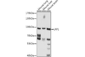 Western blot analysis of extracts of various cell lines, using LRP1 Rabbit pAb (ABIN6130085, ABIN6143323, ABIN6143324 and ABIN6217535) at 1:1000 dilution. (LRP1 Antikörper  (AA 20-270))