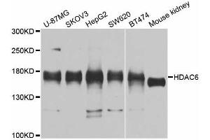 Western blot analysis of extracts of various cell lines, using HDAC6 antibody (ABIN5997880) at 1/1000 dilution. (HDAC6 Antikörper)
