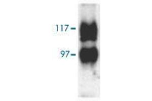 Western blot analysis of Slc14a2 in rat kidney (inner medulla) with Slc14a2 polyclonal antibody  at 1:1000 dilution. (Solute Carrier Family 14 (Urea Transporter, Kidney) Member 2 (SLC14A2) (AA 911-929) Antikörper)