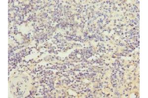 Immunohistochemistry of paraffin-embedded human spleen tissue using ABIN7156852 at dilution of 1:100 (IL21 Receptor Antikörper  (AA 20-240))