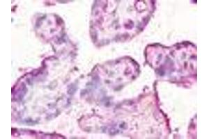 Anti-CCBP2 / D6 antibody IHC of human placenta.