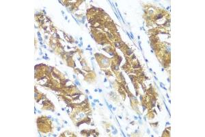 Immunohistochemistry of paraffin-embedded human stomach using NME3 antibody (ABIN3016659, ABIN3016660, ABIN3016661 and ABIN6219806) at dilution of 1:100 (40x lens). (NME3 Antikörper  (AA 20-169))