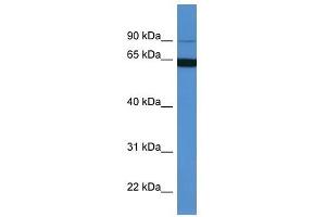 Western Blot showing MAP6 antibody used at a concentration of 1-2 ug/ml to detect its target protein.
