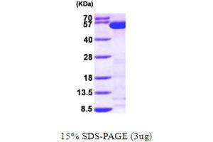 SDS-PAGE (SDS) image for Tryptophanyl-tRNA Synthetase (WARS) (AA 1-471) protein (His tag) (ABIN667149) (WARS Protein (AA 1-471) (His tag))