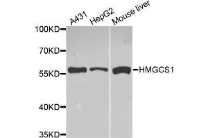 Western Blotting (WB) image for anti-3-Hydroxy-3-Methylglutaryl-CoA Synthase 1 (Soluble) (HMGCS1) (AA 241-520) antibody (ABIN6220423) (HMGCS1 Antikörper  (AA 241-520))