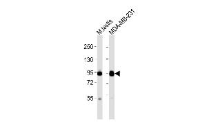 All lanes : Anti-EZH2 Antibody at 1:2000 dilution Lane 1: mouse testis lysates Lane 2: MDA-MB-231 whole cell lysates Lysates/proteins at 20 μg per lane. (EZH2 Antikörper  (N-Term))