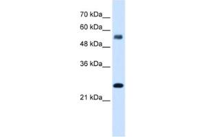 Western Blotting (WB) image for anti-SMAD, Mothers Against DPP Homolog 1 (SMAD1) antibody (ABIN2461768) (SMAD1 Antikörper)