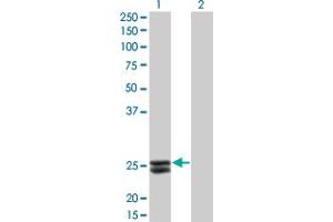 Western Blot analysis of PRL expression in transfected 293T cell line by PRL monoclonal antibody (M02), clone 1E1.