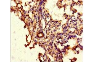 Immunohistochemistry (IHC) image for anti-ATP-Binding Cassette, Sub-Family G (WHITE), Member 8 (ABCG8) (AA 176-413) antibody (ABIN7144942)