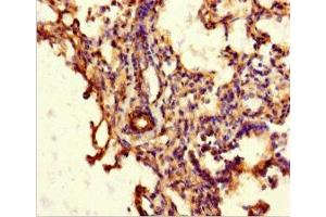 Immunohistochemistry of paraffin-embedded human lung tissue using ABIN7144942 at dilution of 1:100 (ABCG8 Antikörper  (AA 176-413))