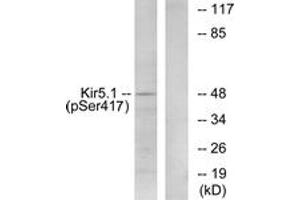 Western blot analysis of extracts from RAW264. (KIR5.1 Antikörper  (pSer417))