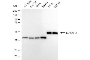Western blotting analysis using SUV39H2 antibody (ABIN7800468).