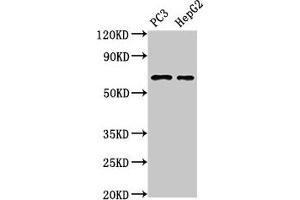 Western Blot Positive WB detected in: PC-3 whole cell lysate, HepG2 whole cell lysate All lanes: PARP2 antibody at 3 μg/mL Secondary Goat polyclonal to rabbit IgG at 1/50000 dilution Predicted band size: 67, 65 kDa Observed band size: 67 kDa (PARP2 Antikörper  (AA 14-149))