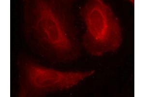 Immunofluorescence staining of methanol-fixed Hela cells using PDK1(Phospho-Ser241) Antibody. (PDPK1 Antikörper  (pSer241))