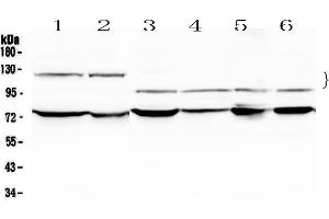 Western blot analysis of NFATC4 using anti-NFATC4 antibody . (NFATC4 Antikörper  (AA 413-522))