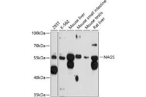 Western blot analysis of extracts of various cell lines, using NAGS antibody (ABIN6130570, ABIN6144346, ABIN6144347 and ABIN6215659) at 1:3000 dilution. (NAGS Antikörper  (AA 295-534))