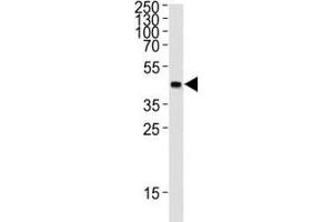 Western blot analysis of lysate from 12 tag recombinant protein (41 kDa) using GST Tag antibody at 1:1000. (GST-Tag Antikörper)