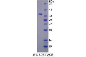 SDS-PAGE analysis of Human MOGS Protein. (GCS1 Protein)