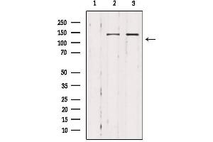 Western blot analysis of extracts from various samples, using MAST3 Antibody.