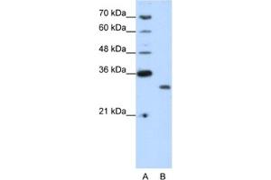 Western Blotting (WB) image for anti-CPX Chromosome Region, Candidate 1 (CPXCR1) antibody (ABIN2461963) (CPXCR1 Antikörper)