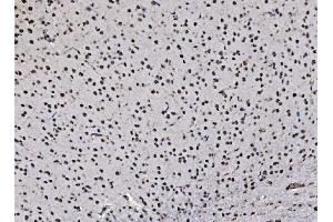 IHC analysis of DBC-1/CCAR2 using anti-DBC-1/CCAR2 antibody (ABIN7602235).