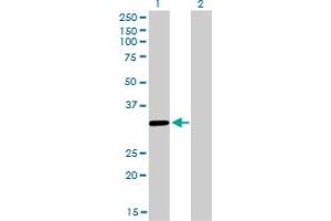 Western Blot analysis of ZNF346 expression in transfected 293T cell line by ZNF346 monoclonal antibody (M01), clone 2D10.