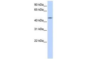 Image no. 1 for anti-Chromosome 20 Open Reading Frame 160 (C20orf160) (AA 71-120) antibody (ABIN6741141) (C20orf160 Antikörper  (AA 71-120))