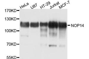 Western blot analysis of extracts of various cell lines, using NOP14 antibody (ABIN5998363) at 1/1000 dilution. (Nop14 Antikörper)
