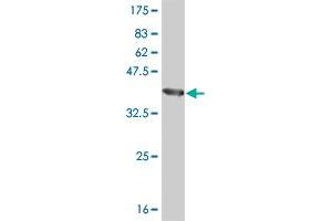 Western Blot detection against Immunogen (40. (BRD3 Antikörper  (AA 418-556))