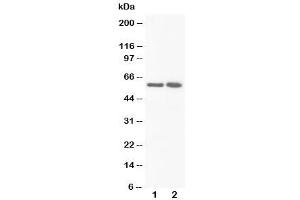 Western blot testing of FMO3 antibody and Lane 1:  rat liver (FMO3 Antikörper  (N-Term))