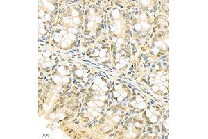 Immunohistochemistry (Paraffin-embedded Sections) (IHC (p)) image for anti-Prothymosin, alpha (PTMA) antibody (ABIN7075306)