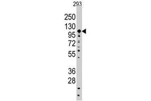 Western blot analysis of SALL4 polyclonal antibody  in 293 cell line lysates (35 ug/lane). (SALL4 Antikörper  (C-Term))
