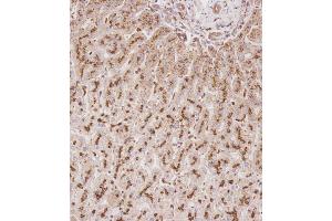 Immunohistochemical analysis of C on paraffin-embedded Human liver tissue. (Glucuronidase beta Antikörper  (AA 335-362))