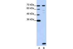 Western Blotting (WB) image for anti-LSM2 Homolog, U6 Small Nuclear RNA Associated (LSM2) antibody (ABIN2462291) (LSM2 Antikörper)